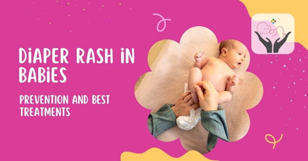 Diaper Rash in Babies
